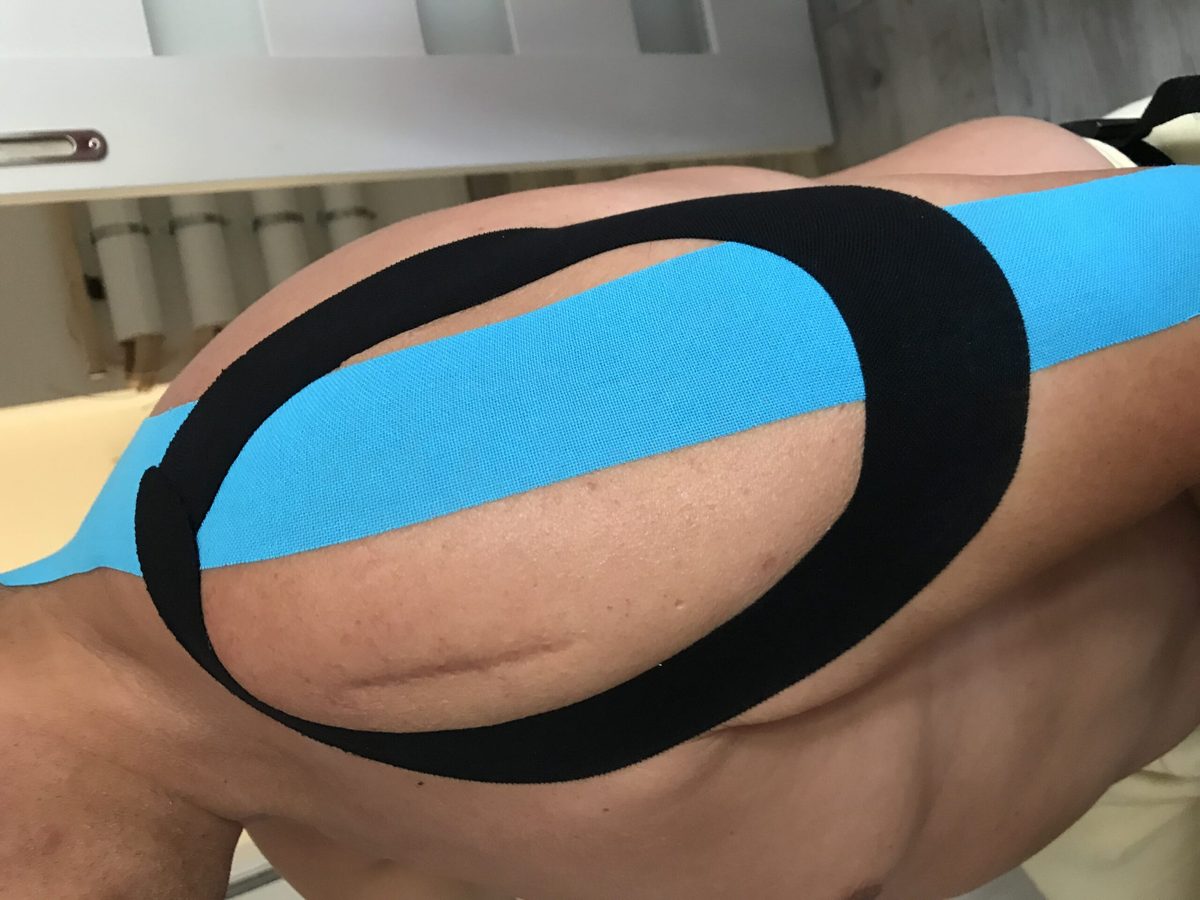 Tape auf dem Unterarm